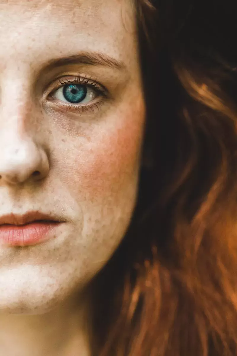 The Best Makeup for Melasma to Cover Hyperpigmentation